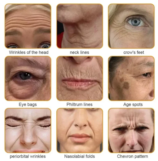AllyBee™ Skin Treatment Cream