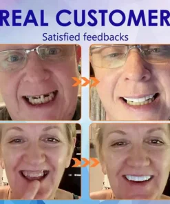QIAWI ™-🦷Advanced Customized Full Denture Set