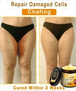 AllyBee® Skin Treatment Cream