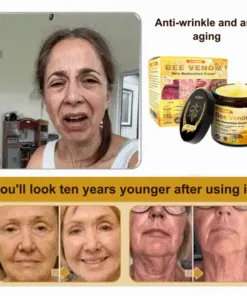AllyBee® Skin Treatment Cream
