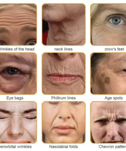 AllyBee® Skin Treatment Cream