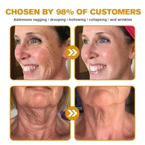 AllyBee® Skin Treatment Cream