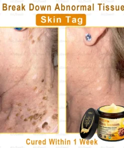 AllyBee® Skin Treatment Cream