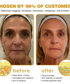AllyBee® Skin Treatment Cream