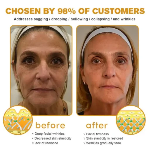 AllyBee® Skin Treatment Cream