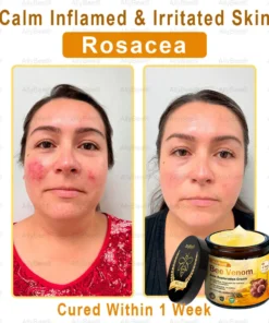 AllyBee® Skin Treatment Cream