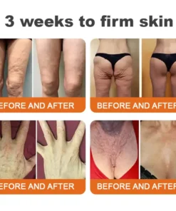 BOTOX Bee Venom All-in-one Treatment Cream