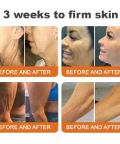 BOTOX Bee Venom All-in-one Treatment Cream