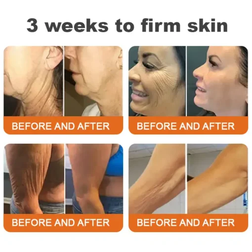 BOTOX Bee Venom All-in-one Treatment Cream