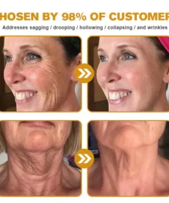 AllyBee® Advanced Skin Treatment Cream