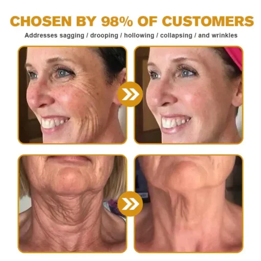 AllyBee® Advanced Skin Treatment Cream