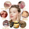 AllyBee® Advanced Skin Treatment Cream