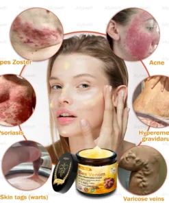 AllyBee® Advanced Skin Treatment Cream
