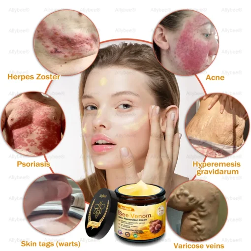 AllyBee® Advanced Skin Treatment Cream
