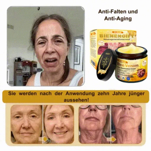 AllyBee® Advanced Skin Treatment Cream