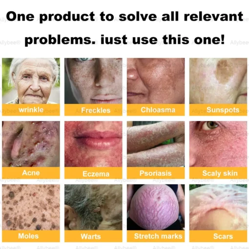 AllyBee® Advanced Skin Treatment Cream