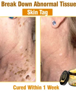 AllyBee® Advanced Skin Treatment Cream