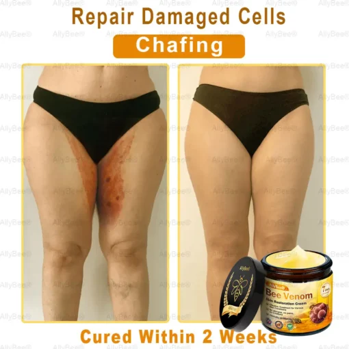 AllyBee® Advanced Skin Treatment Cream