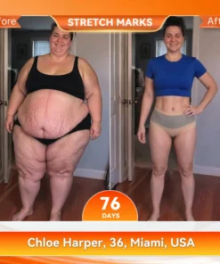 𝑨𝑳𝑳𝒀𝑩𝑬𝑬® Thermogenic Fat-Burning Sculpting Shorts