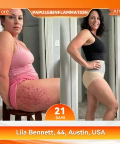 𝑨𝑳𝑳𝒀𝑩𝑬𝑬® Thermogenic Fat-Burning Sculpting Shorts